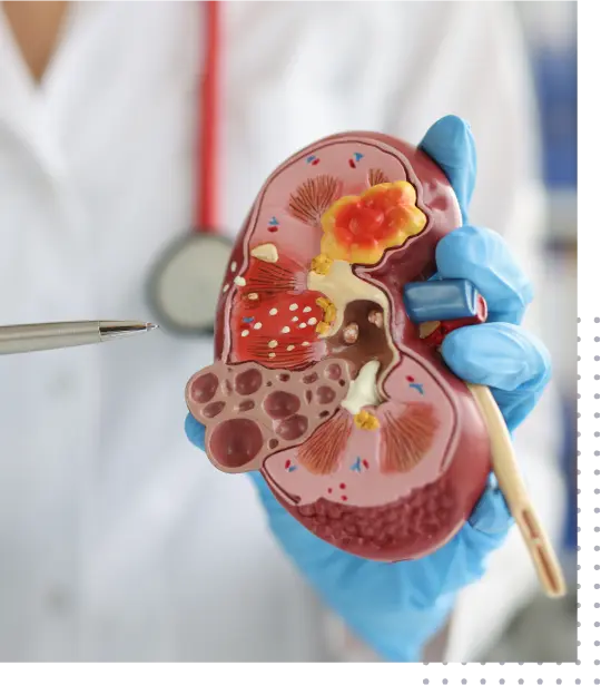 Eliminate Billing Stress with Nephrology Specific Billing Services